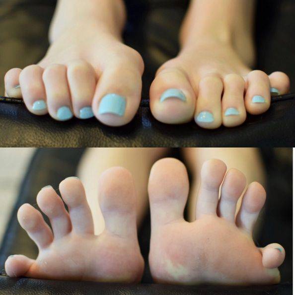 Feet face toenails mouth