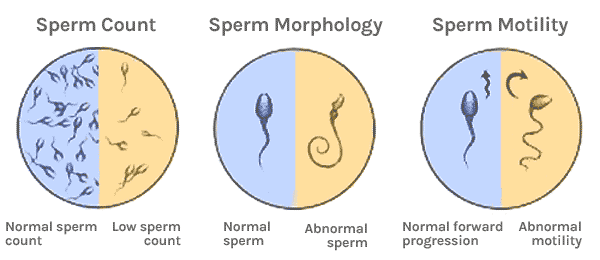 Box K. reccomend Normal movement of sperm through cervical mucus