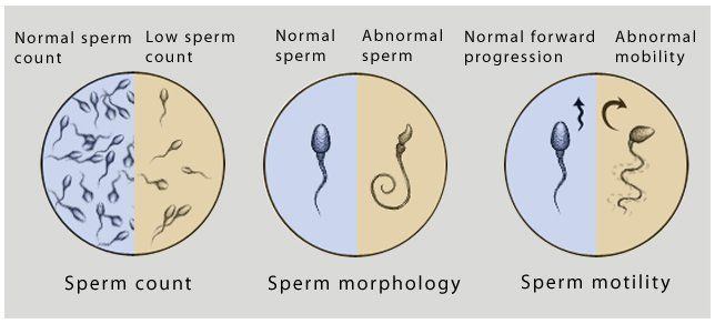 Specimen for sperm count