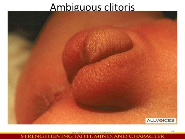 best of Clitoris pics Abnormal