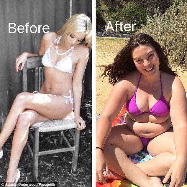 Basecamp reccomend Anorexic woman wearing bikini photo