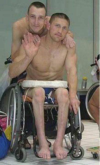 Paraplegic Nude