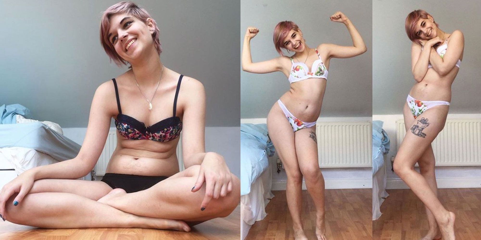 Anorexic woman wearing bikini photo