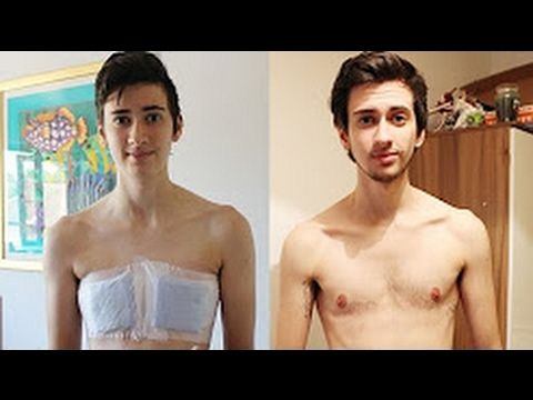 best of Sex operation after pictures change Girls