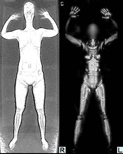 voyeur airport body x ray Adult Pics Hq