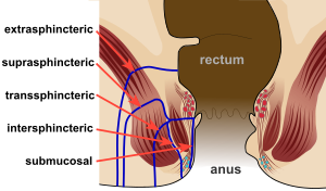 Anal galleries text view