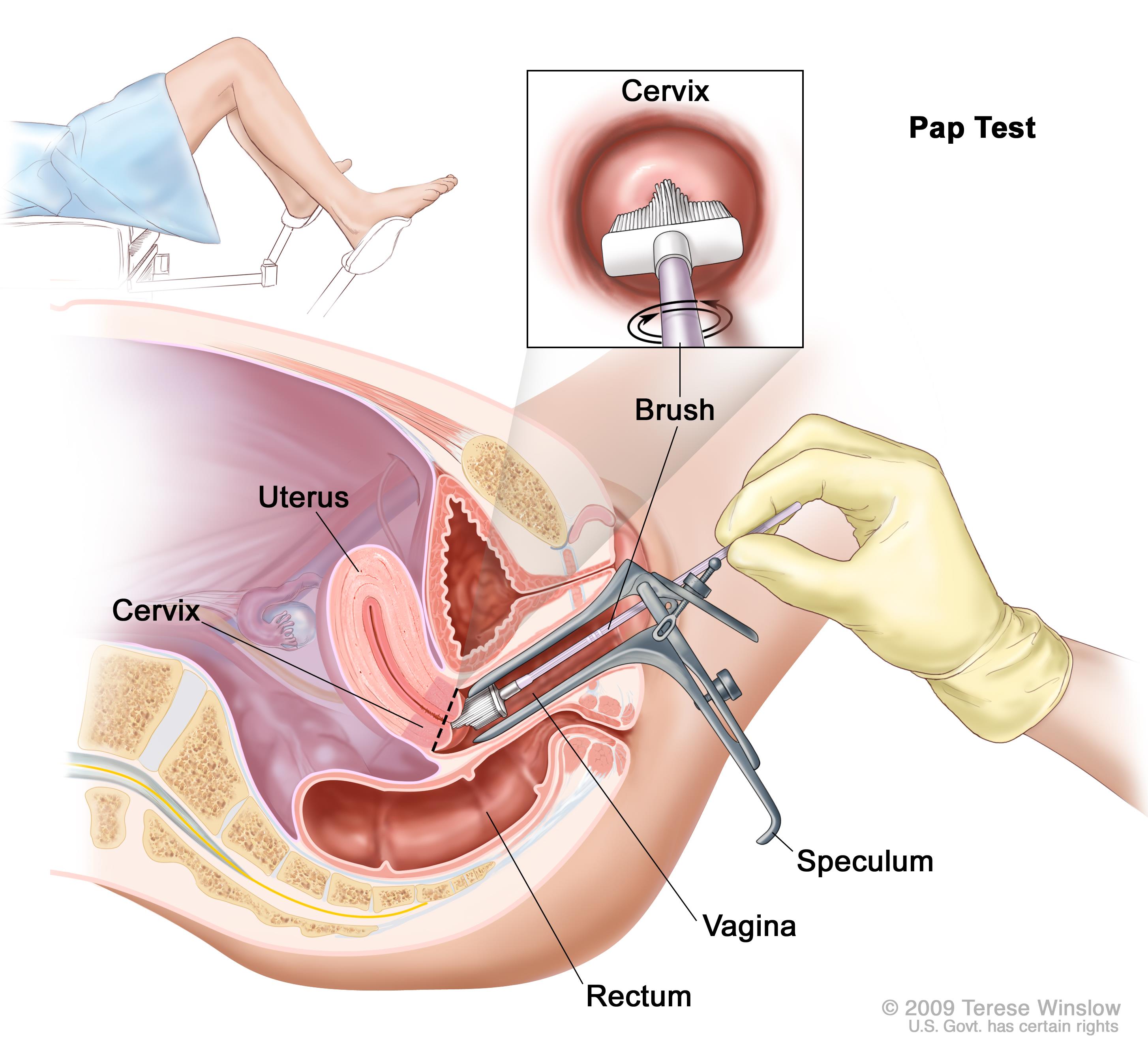 Are all vagina position the same picture