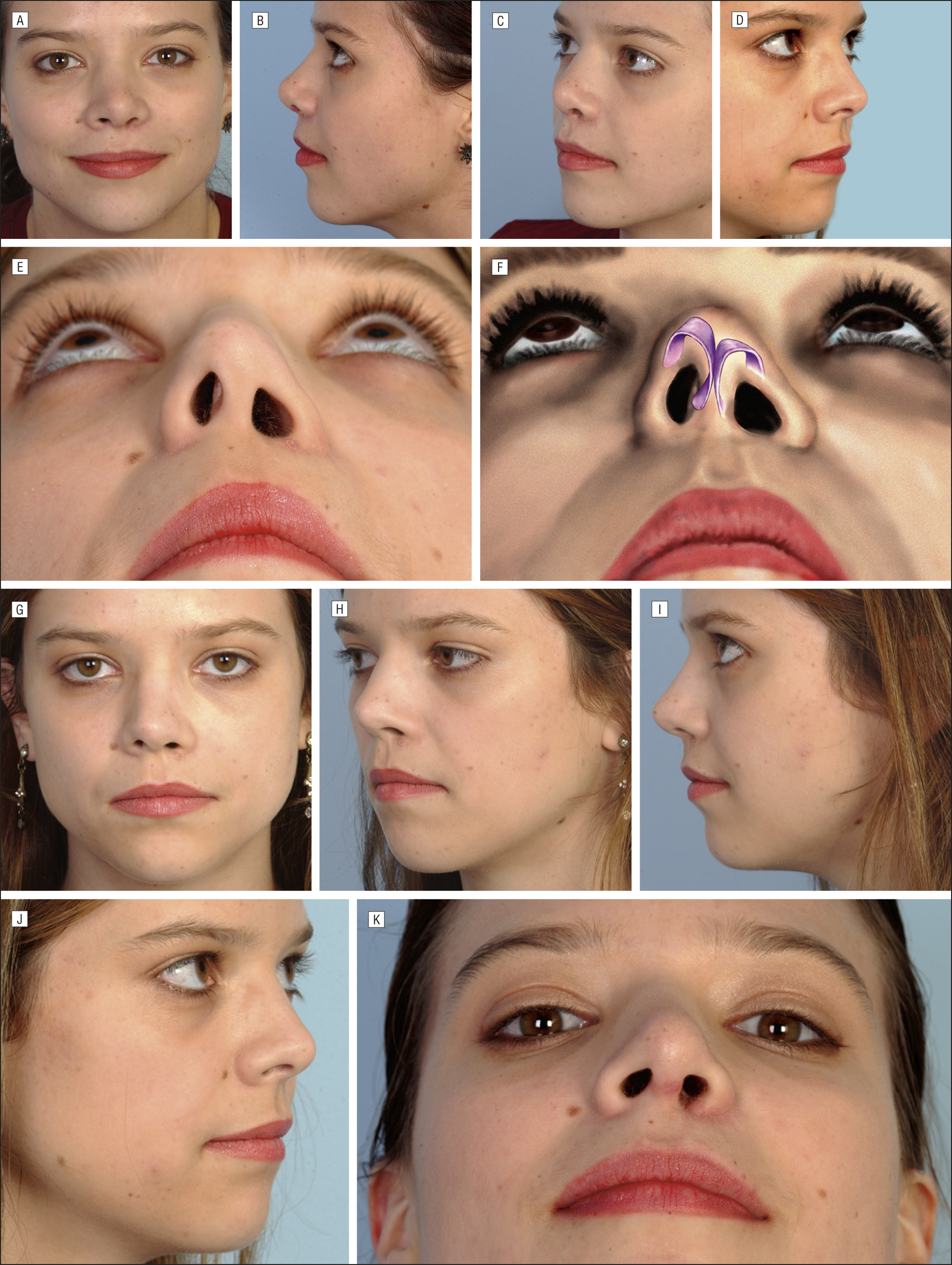 Craniofacial anomalies by ethnicity facial structure