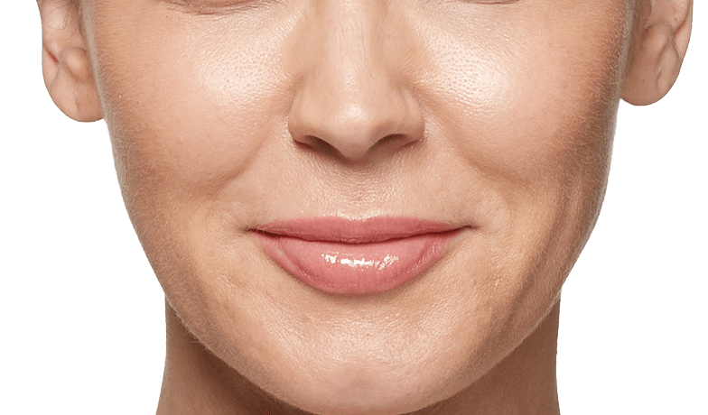 best of Restalyn Facial wrinkles