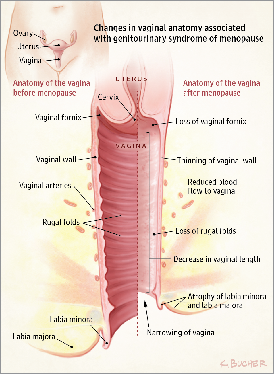 best of Of after sex a vagina Diagram