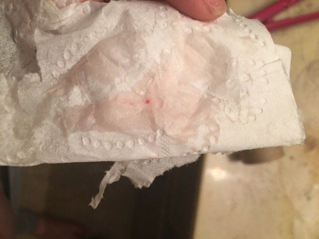 Boomer reccomend Female seeing light pink blood on tissue paper after peeing
