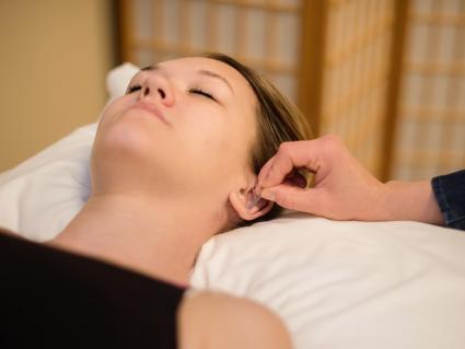 Facial rejuvenation acupuncture training
