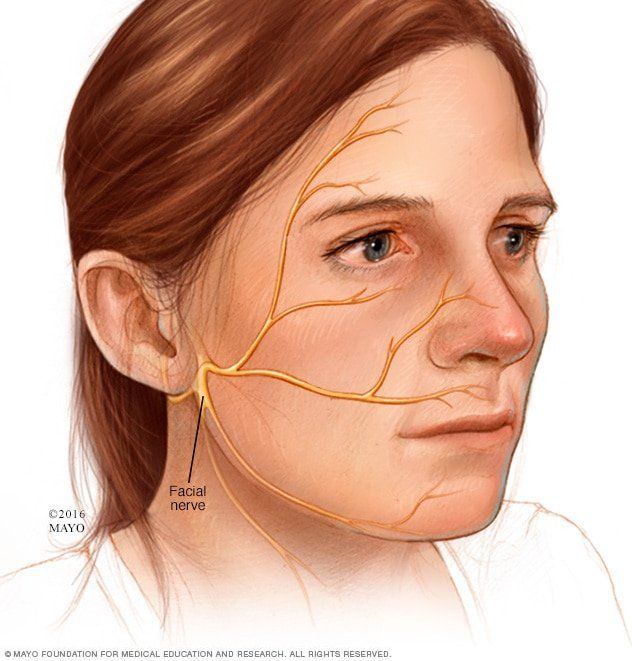 best of Nerve damage eardrum Facial and perforated