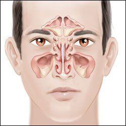 Fumble reccomend Facial weakness following sinus operation