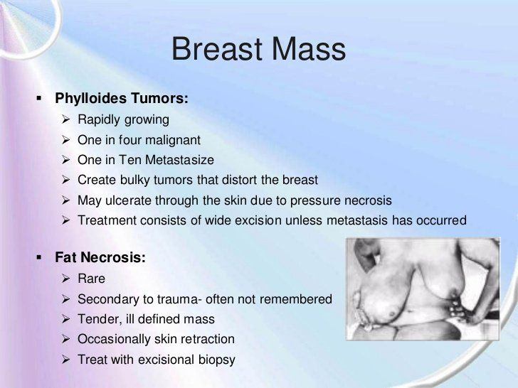 best of Growing breasts Fast cysts in
