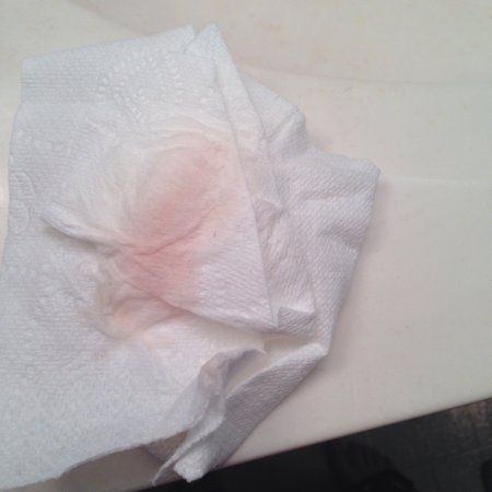 Handyman reccomend Female seeing light pink blood on tissue paper after peeing