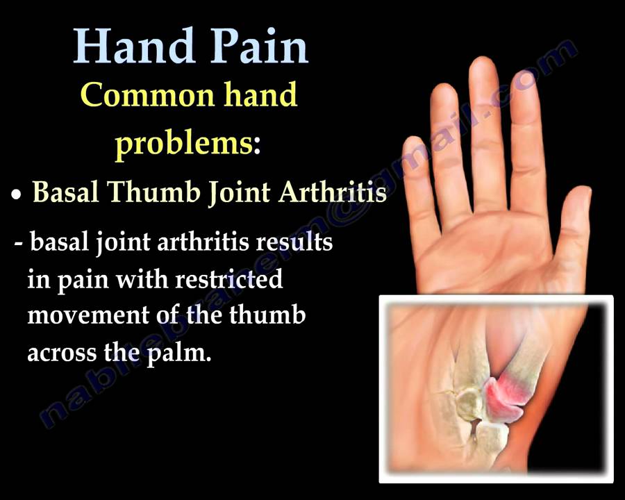 Hand pain top bottom