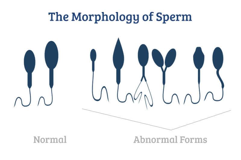 Not producing sperm