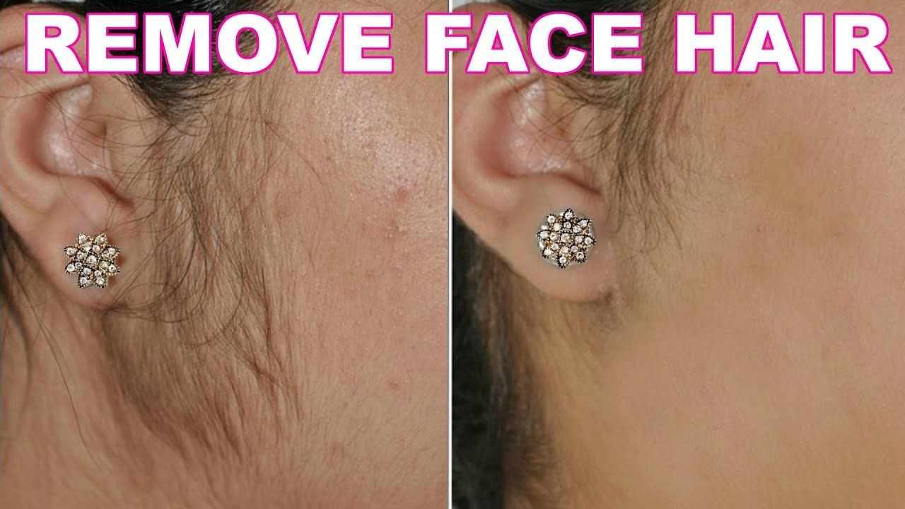Remedies for removing facial hair