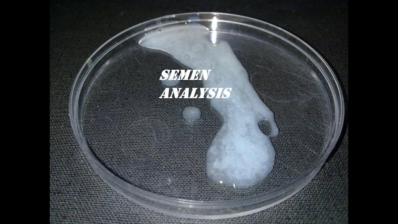 Aqua reccomend Specimen for sperm count